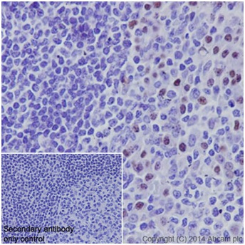 Immunohistochemistry (Formalin/PFA-fixed paraffin-embedded sections) - Anti-PRDM1/Blimp1 antibody [EPR16655] - BSA and Azide free (AB240344), expandable thumbnail