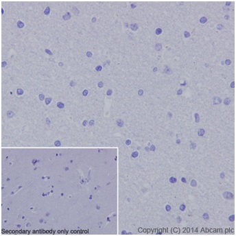 Immunohistochemistry (Formalin/PFA-fixed paraffin-embedded sections) - Anti-PRDM1/Blimp1 antibody [EPR16655] - BSA and Azide free (AB240344), expandable thumbnail