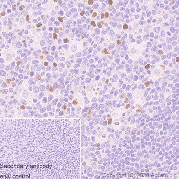 Immunohistochemistry (Formalin/PFA-fixed paraffin-embedded sections) - Anti-PRDM1/Blimp1 antibody [EPR23186-11] - BSA and Azide free (AB272698)