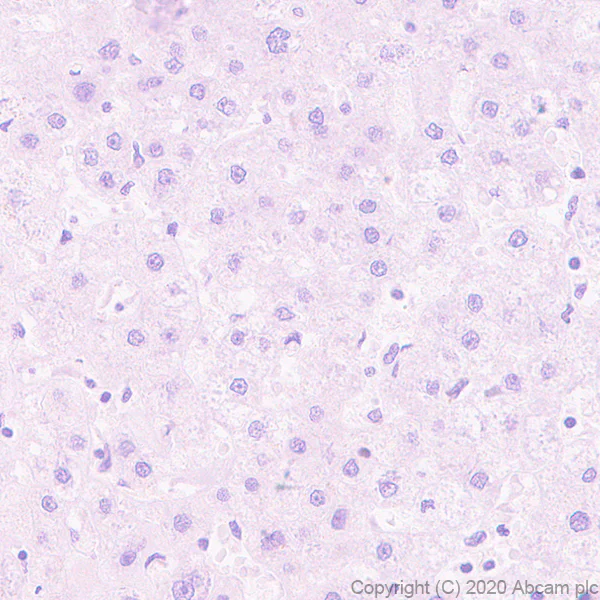 Immunohistochemistry (Formalin/PFA-fixed paraffin-embedded sections) - Anti-PRDM1/Blimp1 antibody [EPR23186-11] - BSA and Azide free (AB272698)