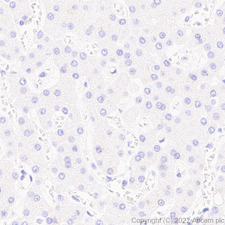 Immunohistochemistry (Formalin/PFA-fixed paraffin-embedded sections) - Anti-PRDM1/Blimp1 antibody [EPR25163-80] (AB307644), expandable thumbnail
