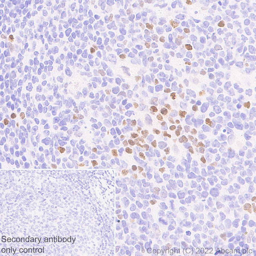 Immunohistochemistry (Formalin/PFA-fixed paraffin-embedded sections) - Anti-PRDM1/Blimp1 antibody [EPR25163-80] (AB307644), expandable thumbnail