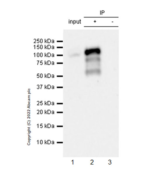 Immunoprecipitation - Anti-PRDM1/Blimp1 antibody [EPR25163-80] (AB307644), expandable thumbnail