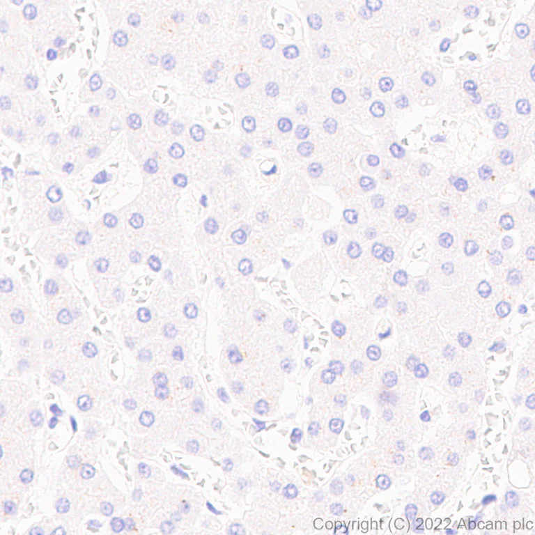 Immunohistochemistry (Formalin/PFA-fixed paraffin-embedded sections) - Anti-PRDM1/Blimp1 antibody [EPR25163-80] - BSA and Azide free (AB307645)