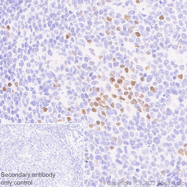 Immunohistochemistry (Formalin/PFA-fixed paraffin-embedded sections) - Anti-PRDM1/Blimp1 antibody [EPR25163-80] - BSA and Azide free (AB307645)
