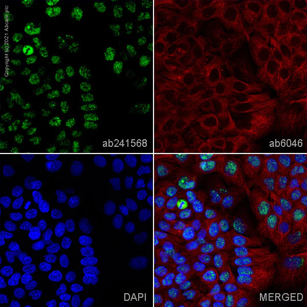 Immunocytochemistry/ Immunofluorescence - Anti-PRDM1/Blimp1 antibody [ROS195G] - BSA and Azide free (AB252785)