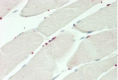 Immunohistochemistry (Formalin/PFA-fixed paraffin-embedded sections) - Anti-PRDM13 antibody - N-terminal (AB230867), expandable thumbnail