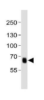 Western blot - Anti-PRDM13 antibody - N-terminal (AB230867), expandable thumbnail