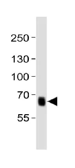 Western blot - Anti-PRDM13 antibody - N-terminal (AB230867)