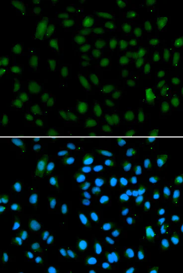 Immunocytochemistry/ Immunofluorescence - Anti-PRDM14 antibody (AB187881)