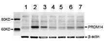 Western blot - Anti-PRDM14 antibody (AB187881)