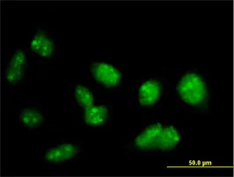 Immunocytochemistry/ Immunofluorescence - Anti-PRDM15 antibody (AB69206)