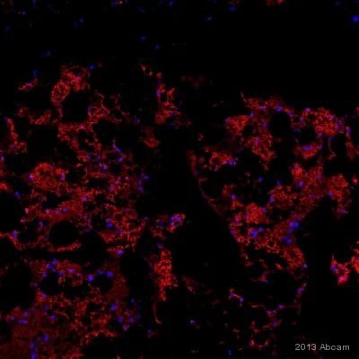 Immunocytochemistry - Anti-PRDM16 antibody (AB106410)