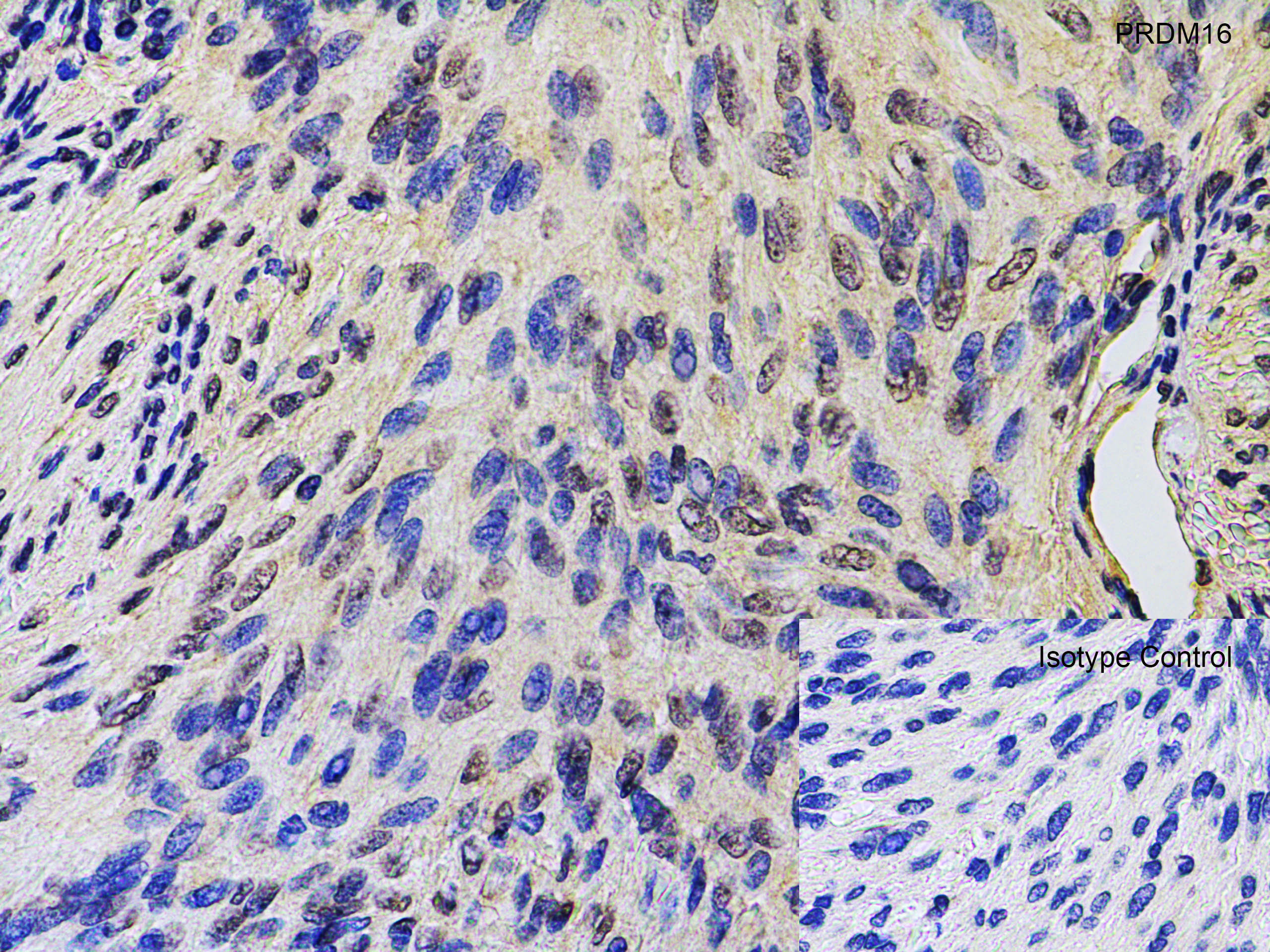 Immunohistochemistry (Formalin/PFA-fixed paraffin-embedded sections) - Anti-PRDM16 antibody (AB106410), expandable thumbnail