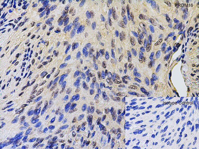 Immunohistochemistry (Formalin/PFA-fixed paraffin-embedded sections) - Anti-PRDM16 antibody (AB106410)