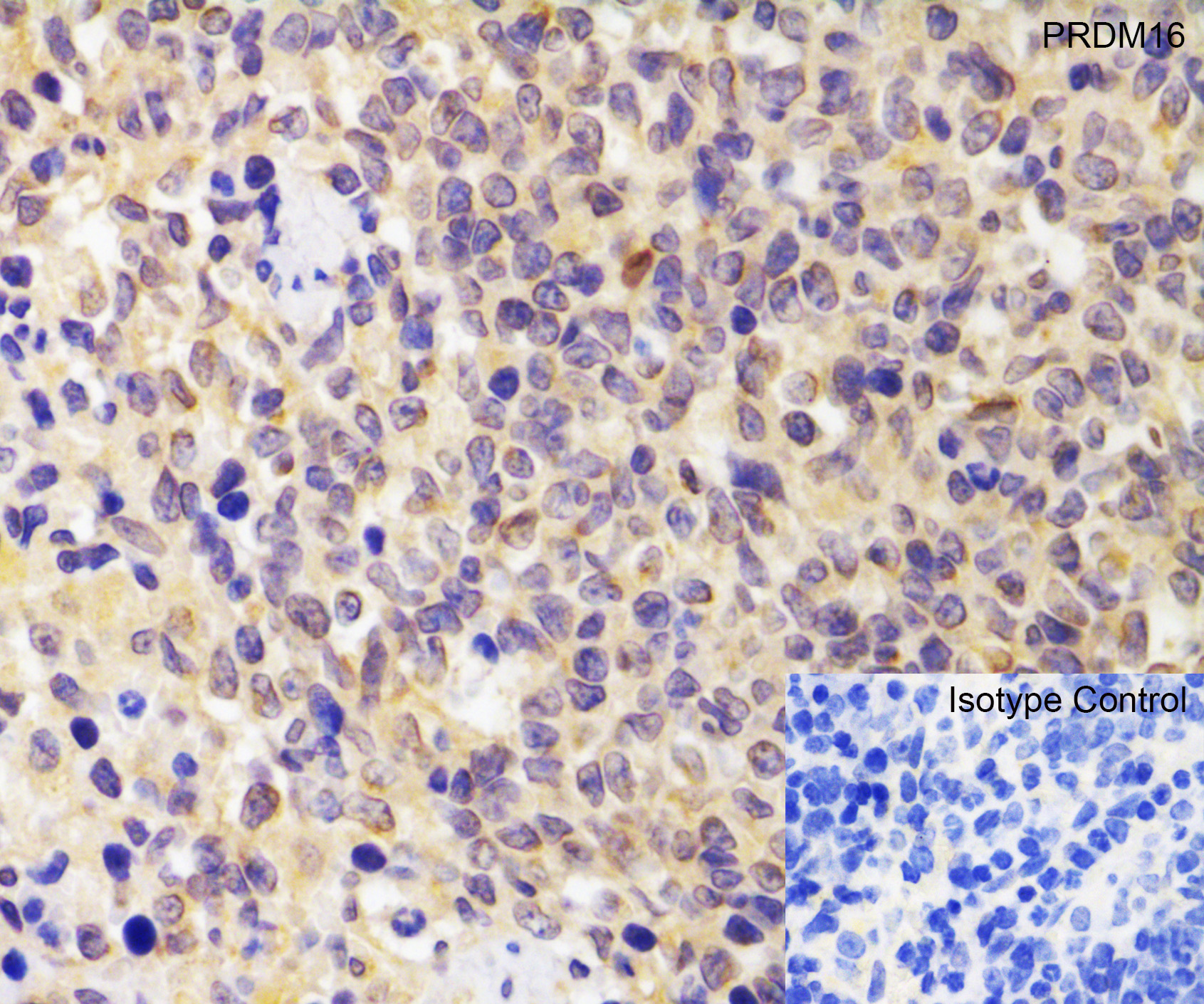 Immunohistochemistry (Formalin/PFA-fixed paraffin-embedded sections) - Anti-PRDM16 antibody (AB106410), expandable thumbnail