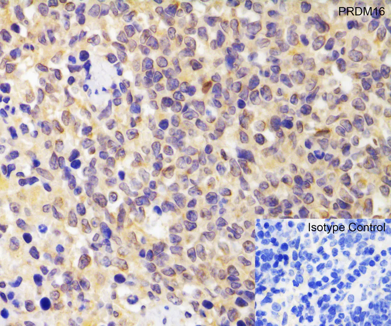 Immunohistochemistry (Formalin/PFA-fixed paraffin-embedded sections) - Anti-PRDM16 antibody (AB106410)