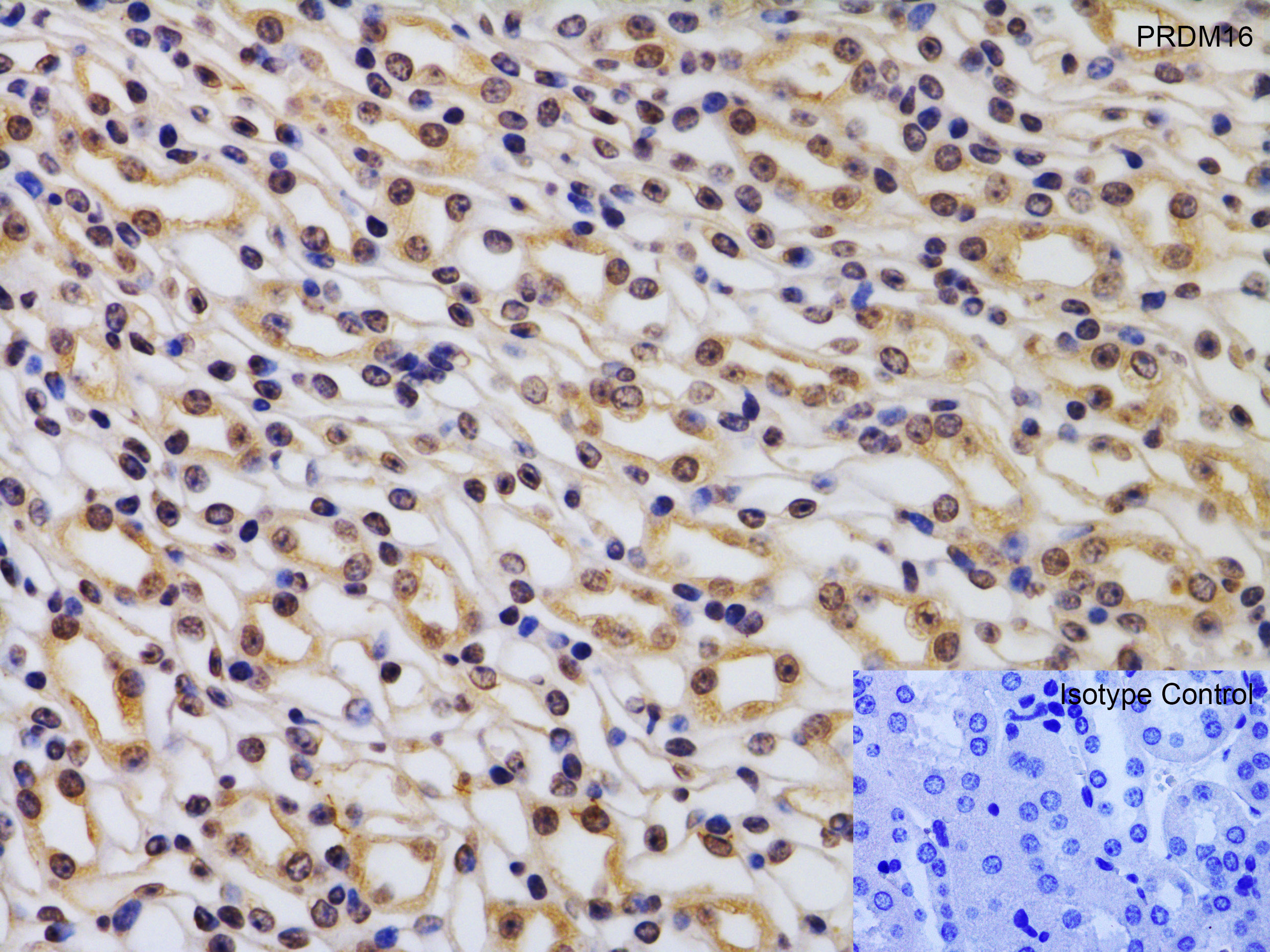 Immunohistochemistry (Formalin/PFA-fixed paraffin-embedded sections) - Anti-PRDM16 antibody (ab106410), expandable thumbnail