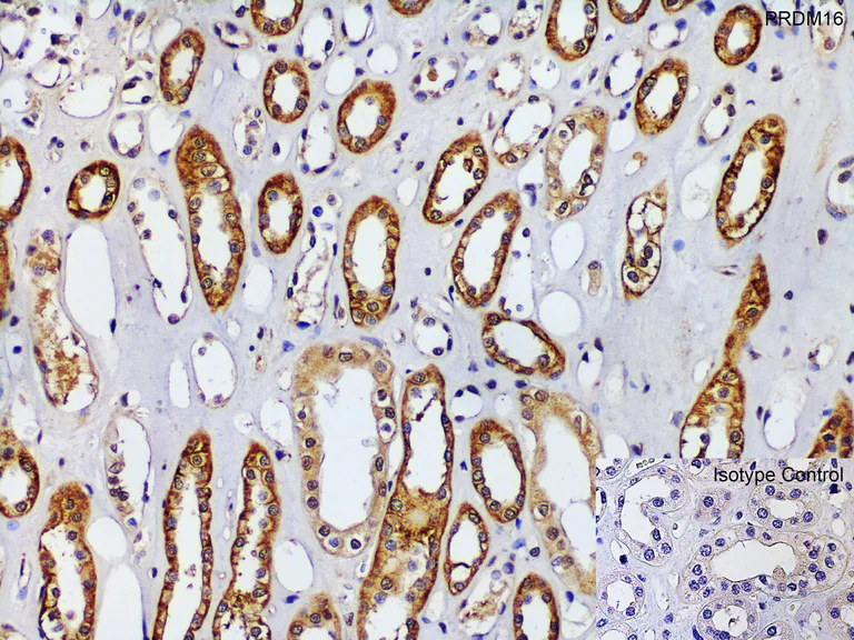 Immunohistochemistry (Formalin/PFA-fixed paraffin-embedded sections) - Anti-PRDM16 antibody (AB106410)