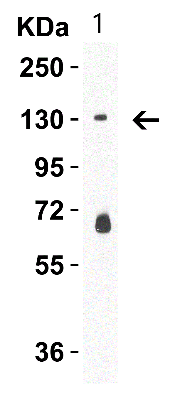 Western blot - Anti-PRDM16 antibody (ab106410), expandable thumbnail