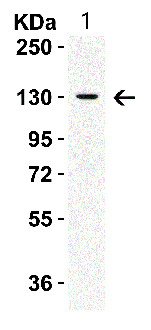 Western blot - Anti-PRDM16 antibody (AB106410), expandable thumbnail