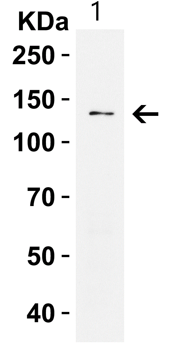 Western blot - Anti-PRDM16 antibody (AB106410), expandable thumbnail