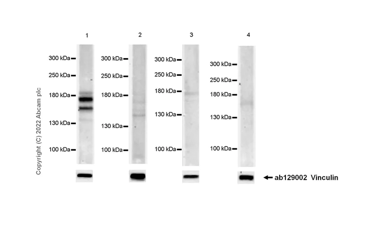 Western blot - Anti-PRDM16 antibody [EPR24315-59] - BSA and Azide free (AB303535)