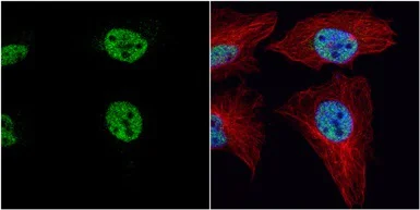 Immunocytochemistry/ Immunofluorescence - Anti-PRDM4/PFM1 antibody (AB126939)