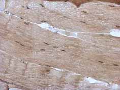 Immunohistochemistry (Formalin/PFA-fixed paraffin-embedded sections) - Anti-PRDM4/PFM1 antibody (AB126939), expandable thumbnail