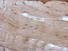 Immunohistochemistry (Formalin/PFA-fixed paraffin-embedded sections) - Anti-PRDM4/PFM1 antibody (AB126939)