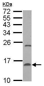 Western blot - Anti-Prealbumin antibody (AB226962), expandable thumbnail