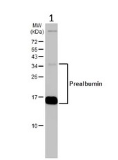 Western blot - Anti-Prealbumin antibody (AB226962)