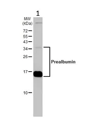 Western blot - Anti-Prealbumin antibody (AB226962)