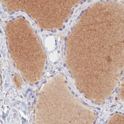 Immunohistochemistry (Formalin/PFA-fixed paraffin-embedded sections) - Anti-Prealbumin antibody [CL0290] (AB188030)