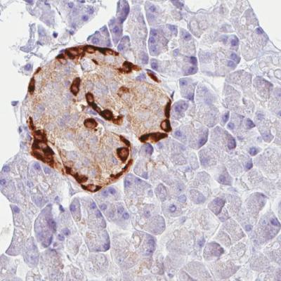 Immunohistochemistry (Formalin/PFA-fixed paraffin-embedded sections) - Anti-Prealbumin antibody [CL0290] (AB188030)