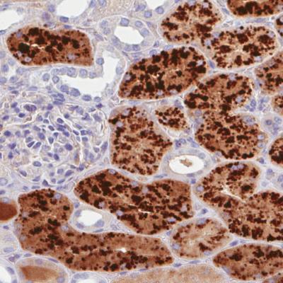 Immunohistochemistry (Formalin/PFA-fixed paraffin-embedded sections) - Anti-Prealbumin antibody [CL0290] (AB188030)