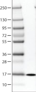 Western blot - Anti-Prealbumin antibody [CL0290] (AB188030)