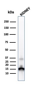 Western blot - Anti-Prealbumin antibody [CPTC-TTR-1] (AB268123)
