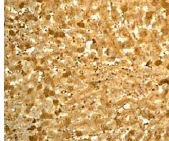 Immunohistochemistry (Formalin/PFA-fixed paraffin-embedded sections) - Anti-Prealbumin antibody [EP2929Y] (AB75815)