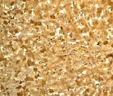 Immunohistochemistry (Formalin/PFA-fixed paraffin-embedded sections) - Anti-Prealbumin antibody [EP2929Y] - BSA and Azide free (AB185127)