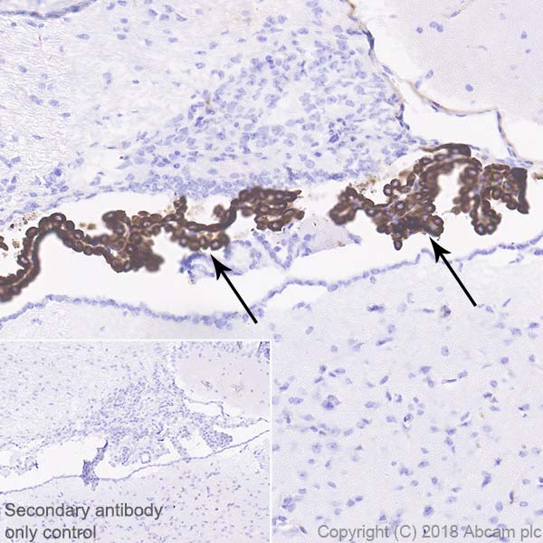 Immunohistochemistry (Formalin/PFA-fixed paraffin-embedded sections) - Anti-Prealbumin antibody [EPR20971] (AB215202), expandable thumbnail