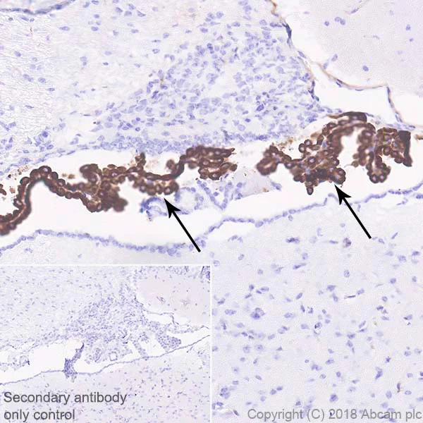Immunohistochemistry (Formalin/PFA-fixed paraffin-embedded sections) - Anti-Prealbumin antibody [EPR20971] (AB215202)