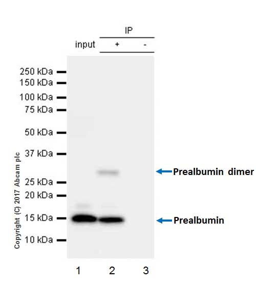 Immunoprecipitation - Anti-Prealbumin antibody [EPR20971] (AB215202), expandable thumbnail