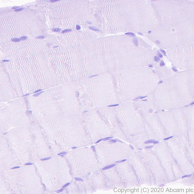 Immunohistochemistry (Formalin/PFA-fixed paraffin-embedded sections) - Anti-Prealbumin antibody [EPR24246-14] (AB271132)