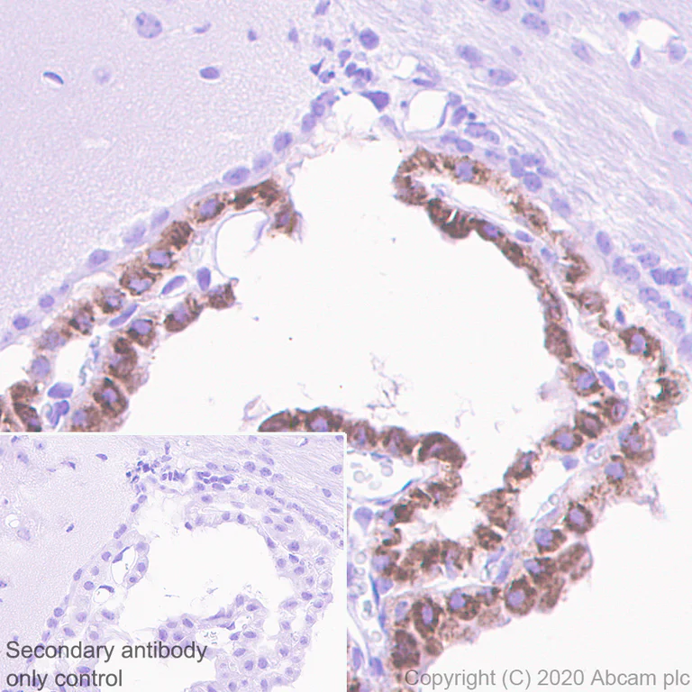 Immunohistochemistry (Formalin/PFA-fixed paraffin-embedded sections) - Anti-Prealbumin antibody [EPR24246-14] (AB271132)