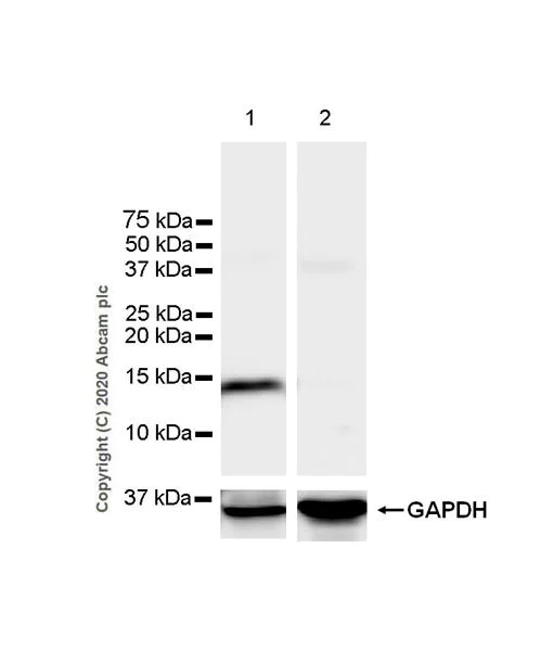 Western blot - Anti-Prealbumin antibody [EPR24246-14] (AB271132)