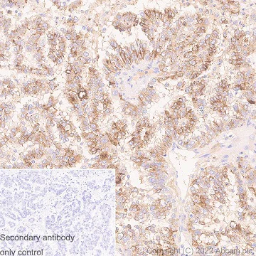 Immunohistochemistry (Formalin/PFA-fixed paraffin-embedded sections) - Anti-Prealbumin antibody [EPR3219] (AB92469)
