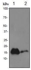 Western blot - Anti-Prealbumin antibody [EPR3219] (AB92469)