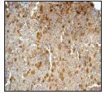 Immunohistochemistry (Formalin/PFA-fixed paraffin-embedded sections) - Anti-Prealbumin antibody [EPR3219] - BSA and Azide free (AB239915)