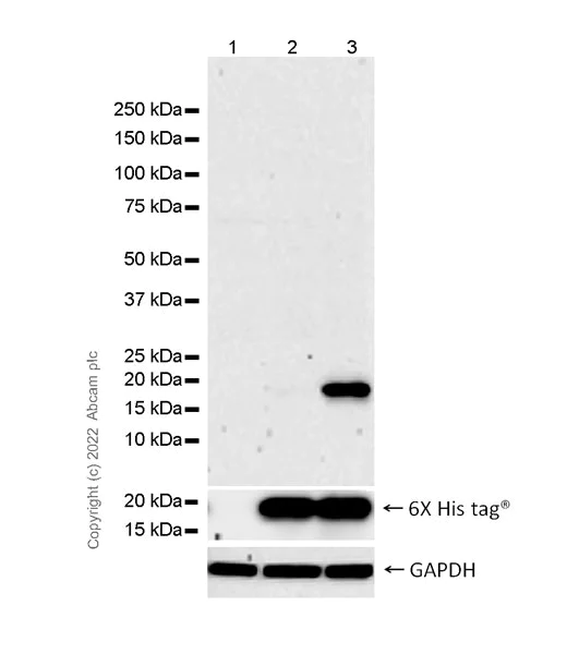 Western blot - Anti-Prealbumin (mutated V30M) antibody [EPR24341-111] - BSA and Azide free (AB303503)